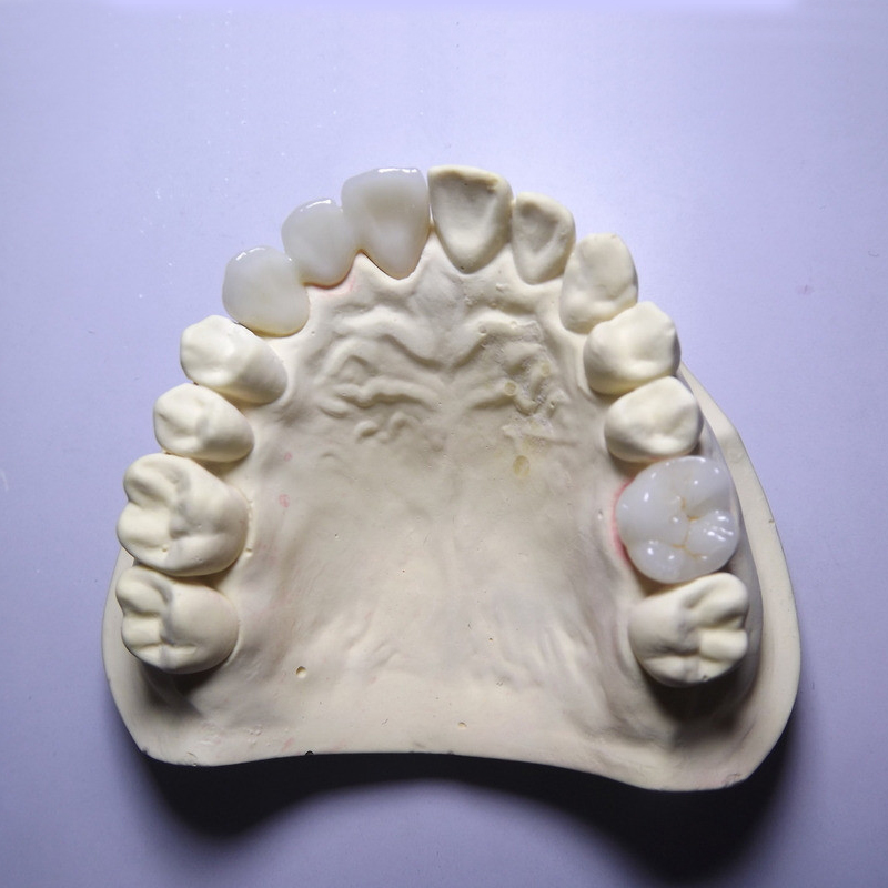 Zirconia nhiều lớp