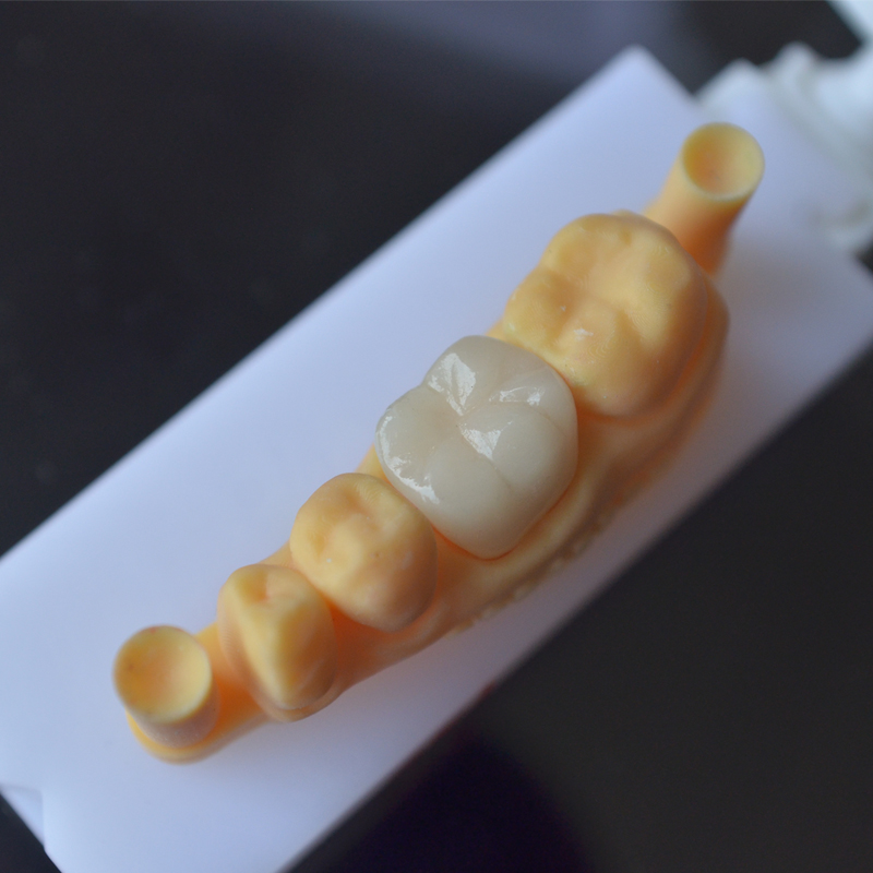 Vỏ kỹ thuật số