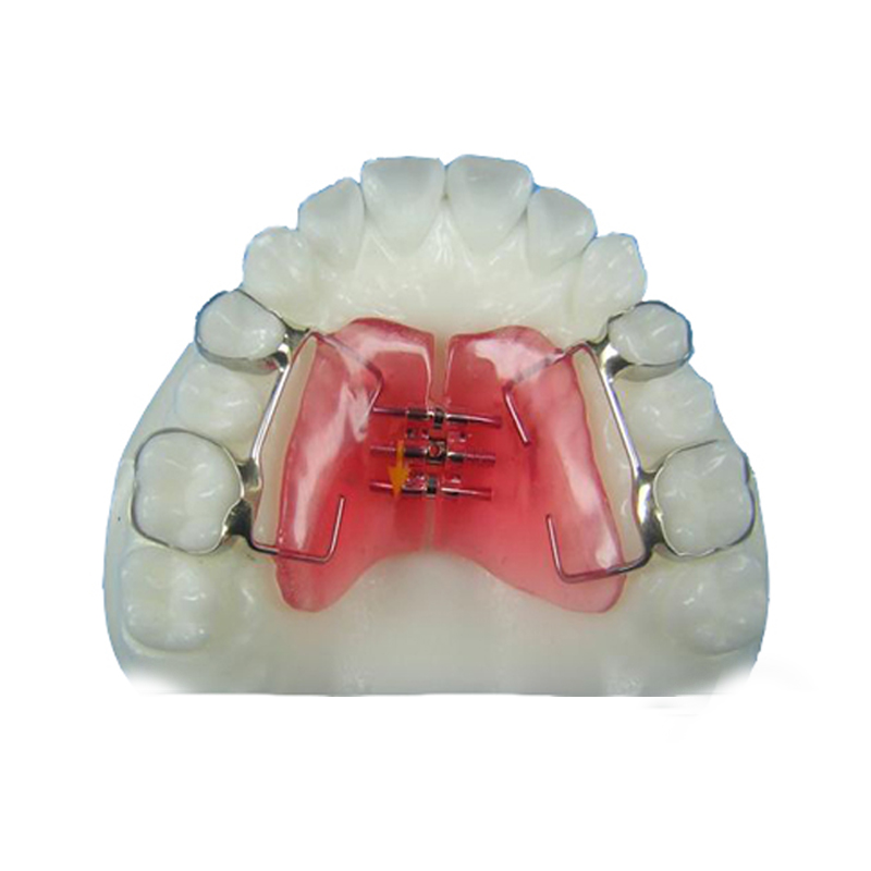 Máy mở rộng Haas Palatal