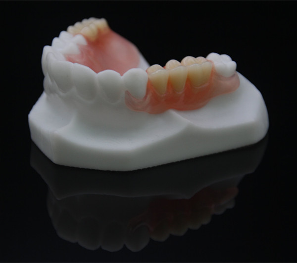 4 tác dụng phụ của chỉnh nha không nên bỏ qua