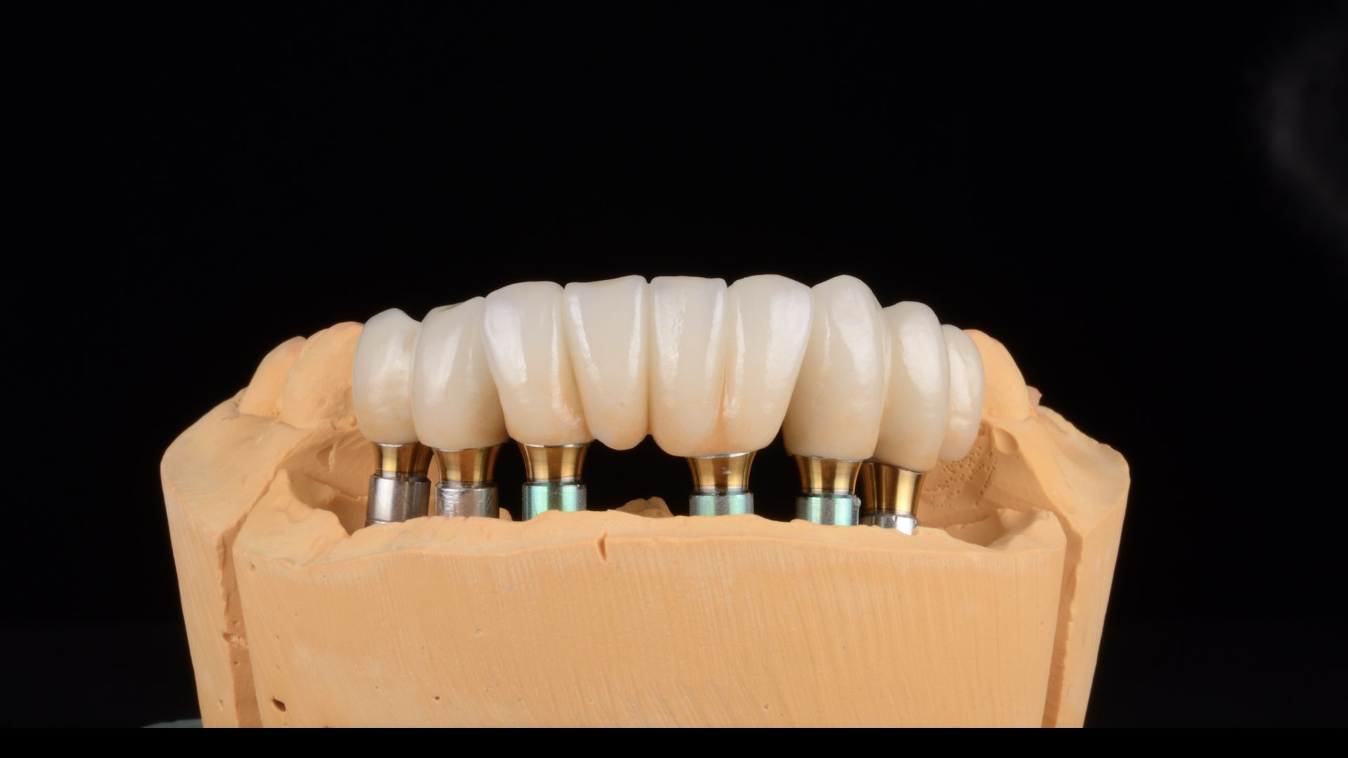 Chăm sóc răng implant như thế nào?