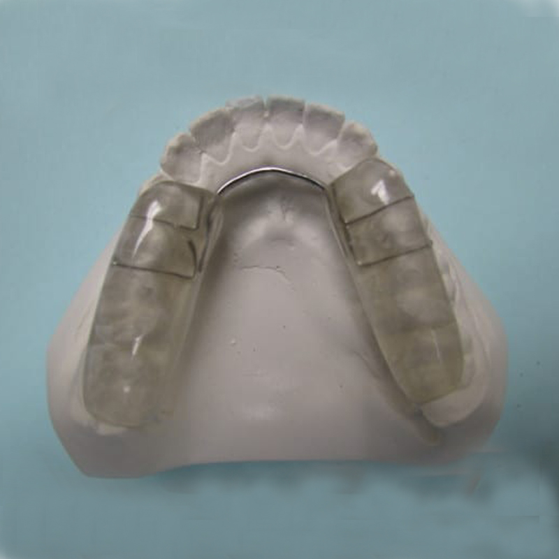Giới thiệu và chỉ định nẹp khớp cắn ổn định