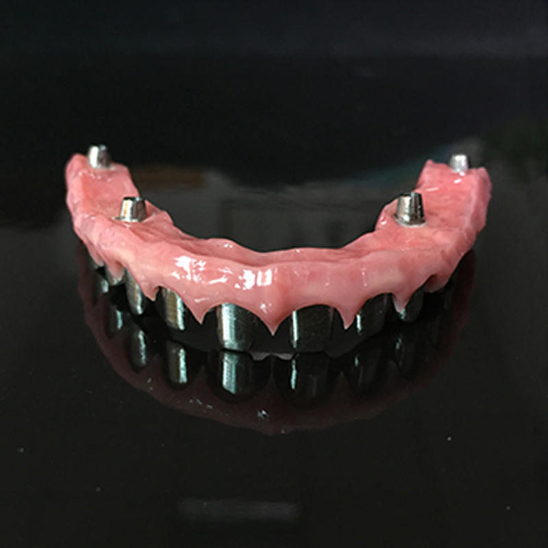 Định nghĩa về trồng răng implant