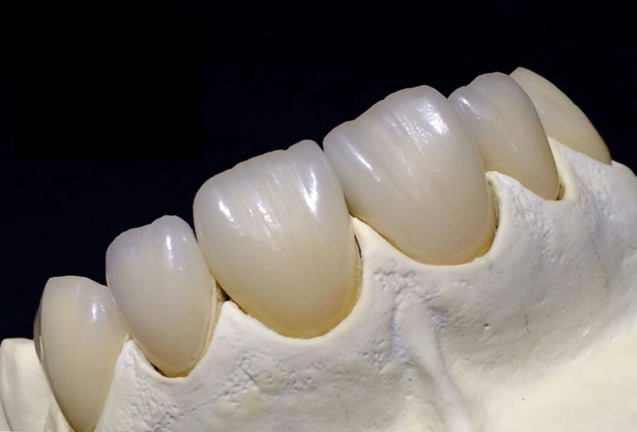 Toàn bộ vật liệu sứ zirconium dioxide