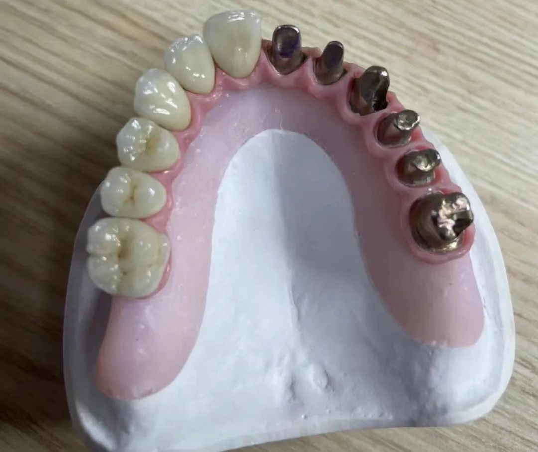 Ưu điểm và nhược điểm của CẦU MALO