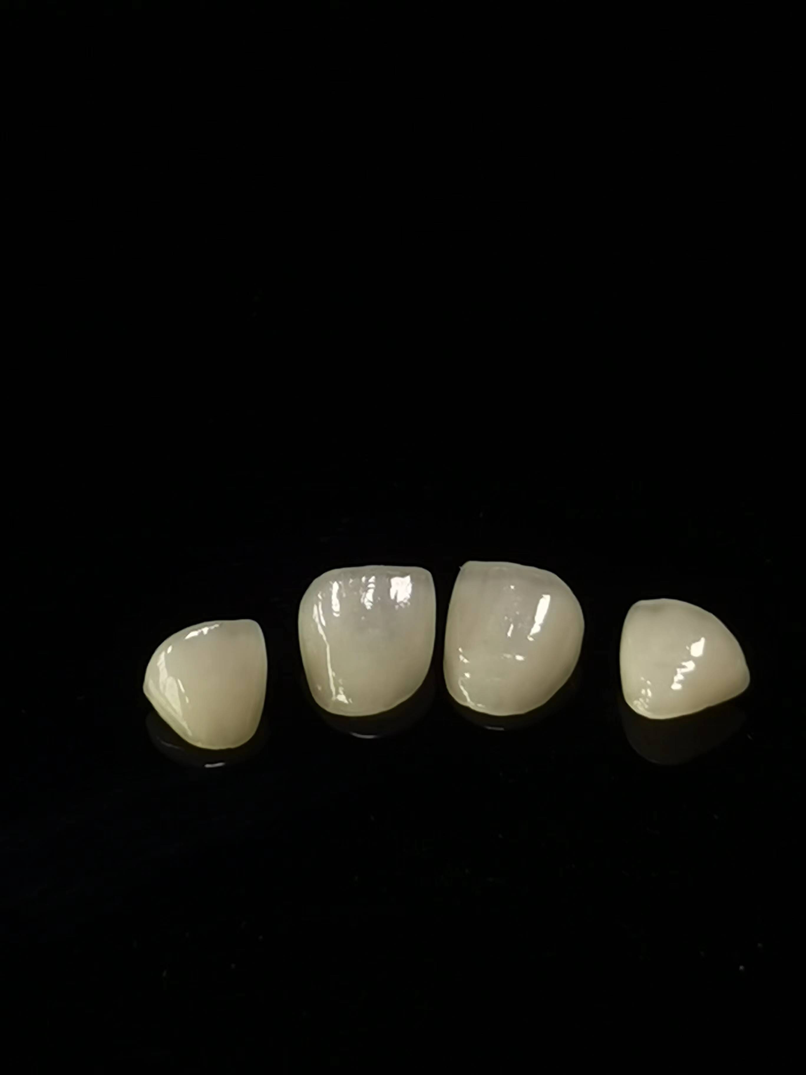Phòng thí nghiệm nha khoa E.max