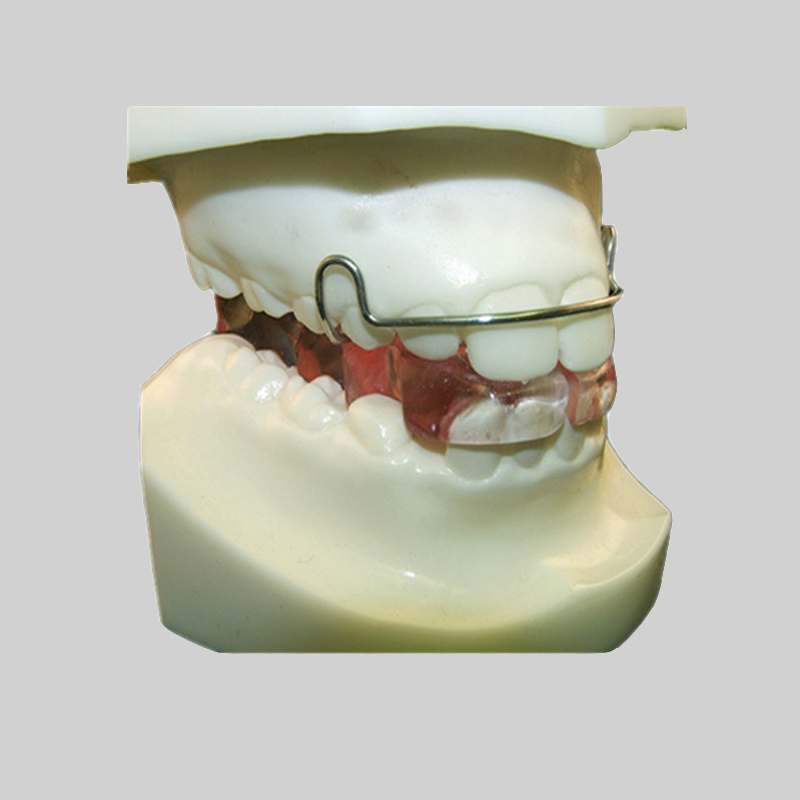 Sự khác biệt giữa chỉnh nha và điều trị chỉnh nha là gì?