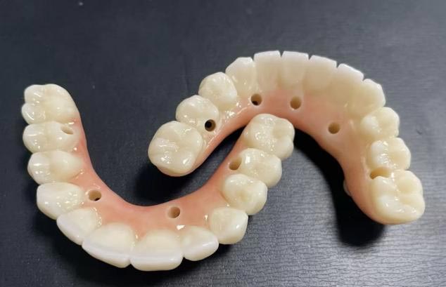 Cái nào tốt hơn: răng giả có thể tháo rời hoặc răng giả cố định?