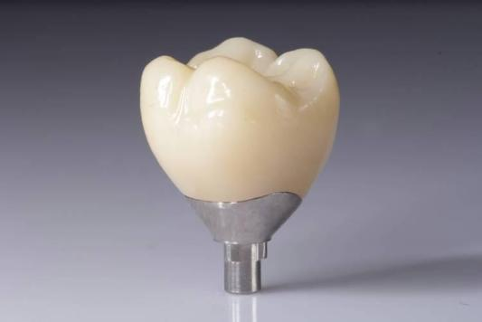 Tối ưu hóa kết quả của bạn với phục hình Zirconia (Mão răng, cầu răng, cấy ghép)