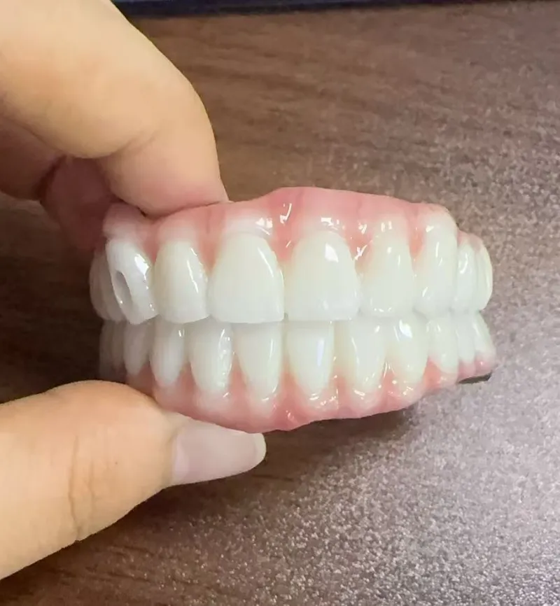 Nguy hiểm của sai khớp cắn
