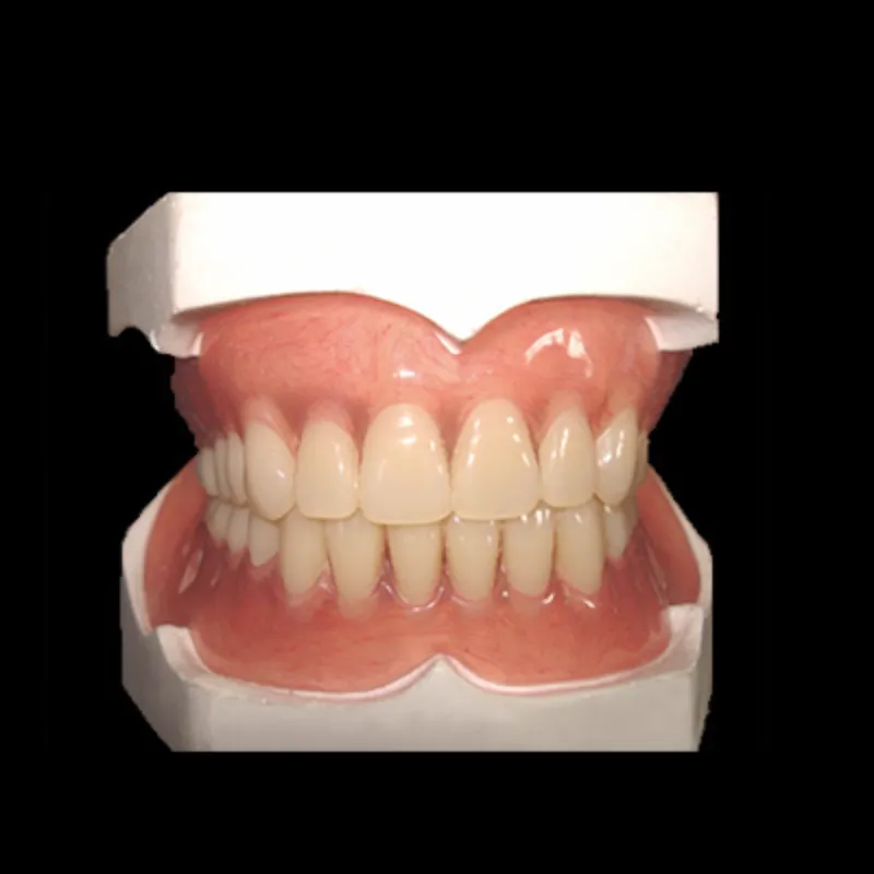 Tại sao răng giả toàn acrylic đôi khi bị gãy và có thể sửa chữa được không?