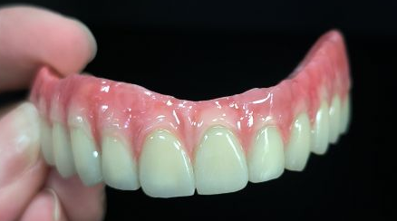Tất cả trên 4 Hybrid - Maro Bridge Full Zirconia trên cấu trúc Titanium
