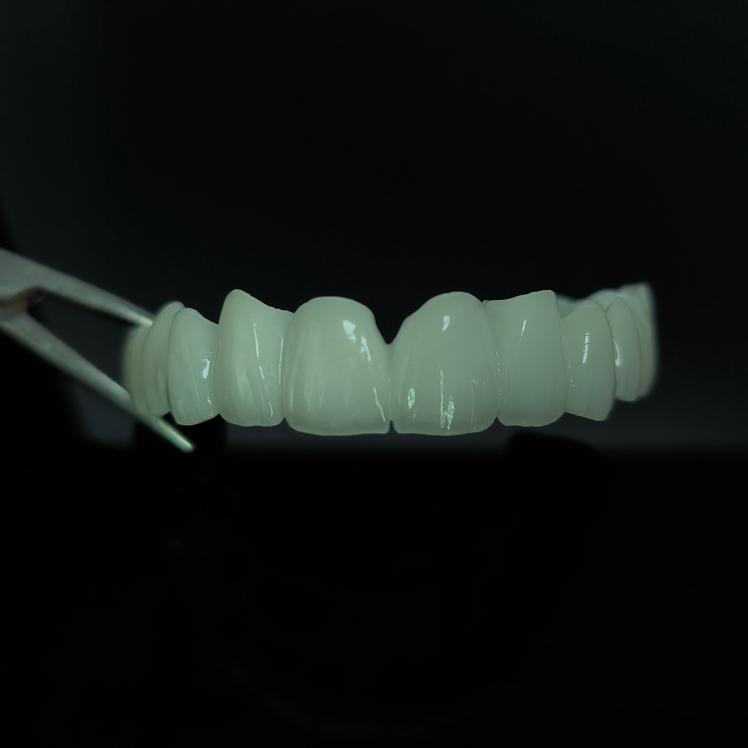 Cầu Zirconia trong mờ cao Lớp Zirconia Trung Quốc Phòng thí nghiệm nha khoa