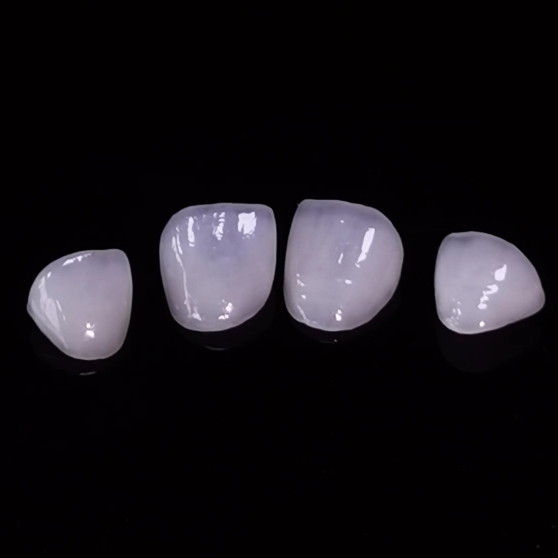 Veneer nha khoa mờ Hight Layered Emax Veneer Phòng thí nghiệm nha khoa