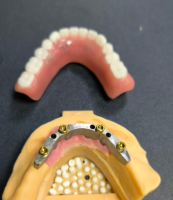 Định vị và thanh nha khoa